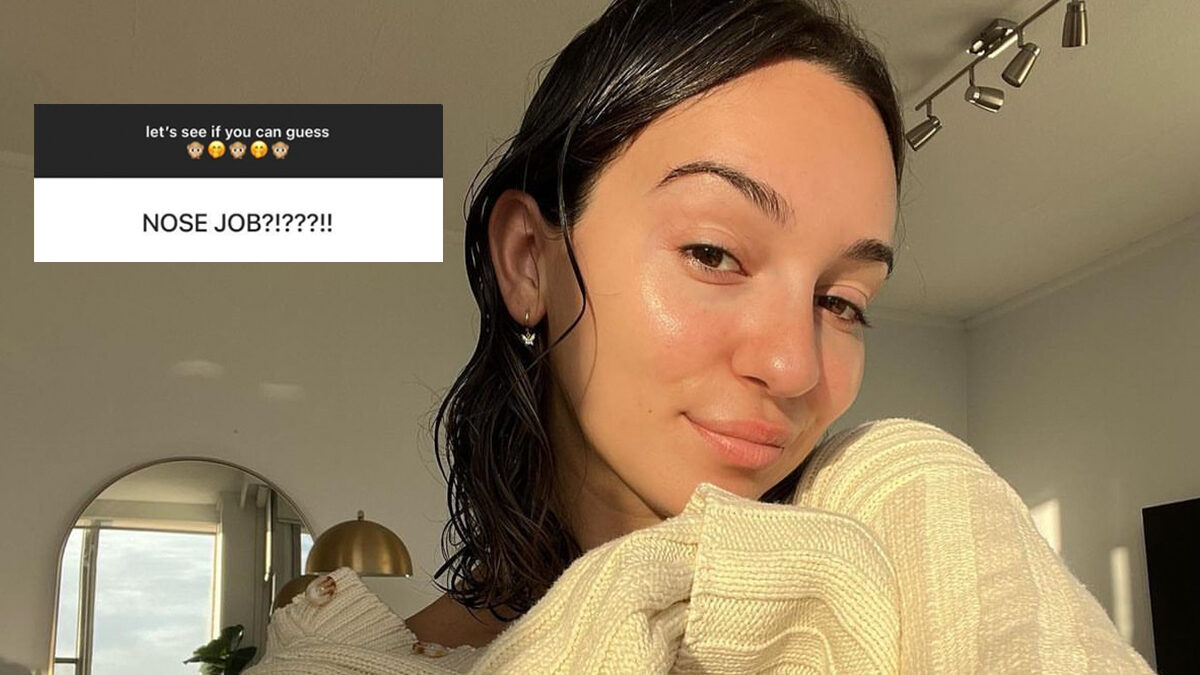 bella varelis nose job