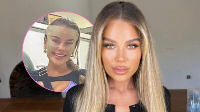 skye hits back surgery backlash